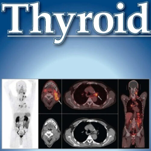 Διεθνής δημοσίευση στο κορυφαίο επιστημονικό περιοδικό Thyroid (επετειακή έκδοση) με υψηλό impact factor, όπου ελάχιστοι Έλληνες ερευνητές έχουν δημοσιεύσει τα τελευταία χρόνια