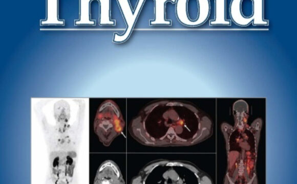 Διεθνής δημοσίευση στο κορυφαίο επιστημονικό περιοδικό Thyroid (επετειακή έκδοση) με υψηλό impact factor, όπου ελάχιστοι Έλληνες ερευνητές έχουν δημοσιεύσει τα τελευταία χρόνια